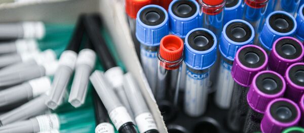 Тестирование россиян на наличие антител к COVID-19 - Sputnik Узбекистан