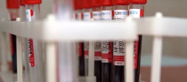 В России завершился первый этап испытания вакцины против COVID-19 В России завершился первый этап испытания вакцины против COVID-19 - Sputnik Узбекистан