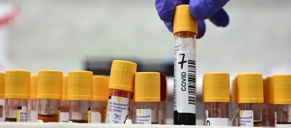 Sotrudnik laboratorii Nauchno-issledovatelskogo instituta skoroy pomoshi imeni N. V. Sklifosovskogo derjit konteyneri s biomaterialom dlya proverki na nalichie novoy koronavirusnoy infeksii. Sotrudnik laboratorii Nauchno-issledovatelskogo instituta skoroy pomoshi imeni N. V. Sklifosovskogo derjit konteyneri s biomaterialom dlya proverki na nalichie novoy koronavirusnoy infeksii. - Sputnik O‘zbekiston