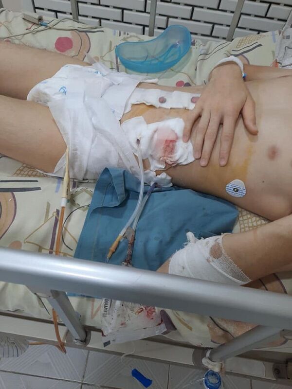 Pichoqlanib og‘ir ahvolda yotgan o‘smirning onasi prezidentga murojaat qildi Pichoqlanib og‘ir ahvolda yotgan o‘smirning onasi prezidentga murojaat qildi - Sputnik O‘zbekiston