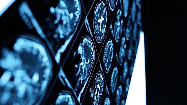 МРТ-снимок головного мозга - Sputnik Ўзбекистон