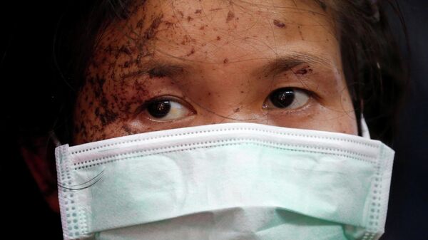 Человек, раненный в ходе протестов в Мьянме - Sputnik Узбекистан