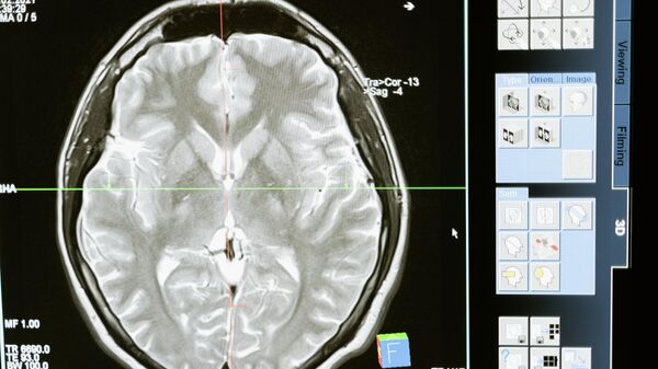 МРТ головного мозга - Sputnik Ўзбекистон