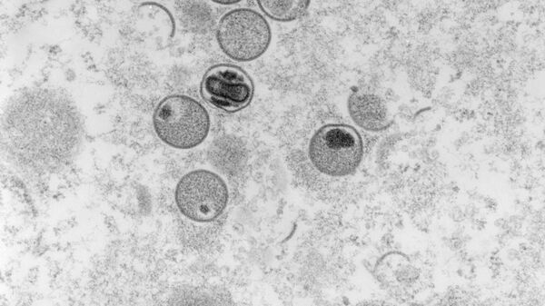 Вирус оспы обезьян под микроскопом - Sputnik Ўзбекистон