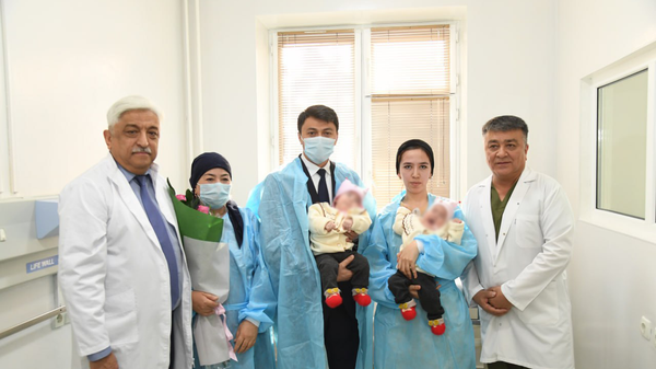 Сиамские близнецы из Кыргызстана были разделены в результате уникальной операции в Узбекистане - Sputnik Узбекистан