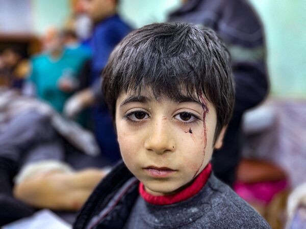 Раненый ребенок ожидает лечения в отделении неотложной помощи больницы Баб аль-Хава после землетрясения. - Sputnik Узбекистан