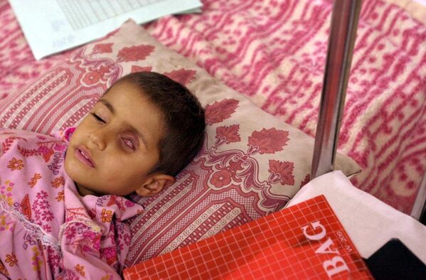 Четырехлетняя Алла Салим, страдающая от опухоли в глазу, вызванной последствиями бомбардировок снарядами с обедненным ураном во время войны в Персидском заливе, в детской больнице Газван в городе Басра на юге Ирака. - Sputnik Узбекистан