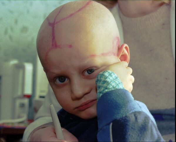 Пятилетний пациент с лейкемией в детском онкологическом отделении Гомельской областной больницы. Беларусь, 19 марта 1996 г.  - Sputnik Узбекистан