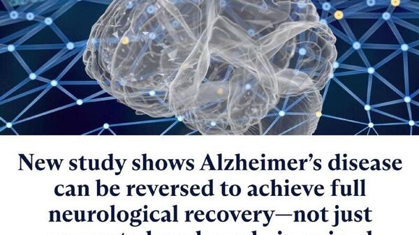 Болезнь Альцгеймера считается необратимой, но оказалось, что можно добиться полного восстановления - Sputnik Узбекистан