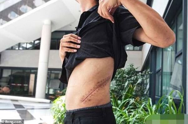 Китаец продал внутренний орган, чтобы купить заветный iPhone – шокирующее фото - Sputnik Узбекистан