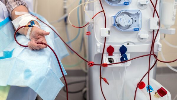 Пациент во время процедуры очистки крови на аппарате Искусственная почка - Sputnik Ўзбекистон