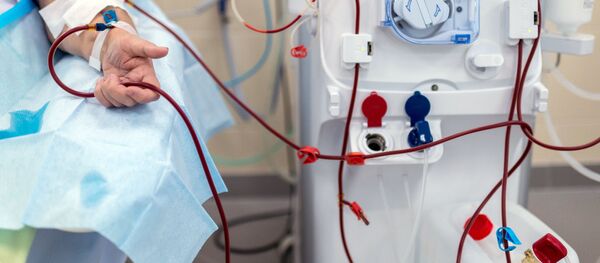 Пациент во время процедуры очистки крови на аппарате Искусственная почка Пациент во время процедуры очистки крови на аппарате Искусственная почка - Sputnik Ўзбекистон