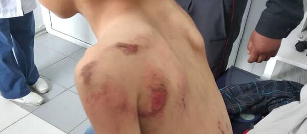 Ребенка в Кыргызстане привязали к машине и протащили по земле - Sputnik Узбекистан