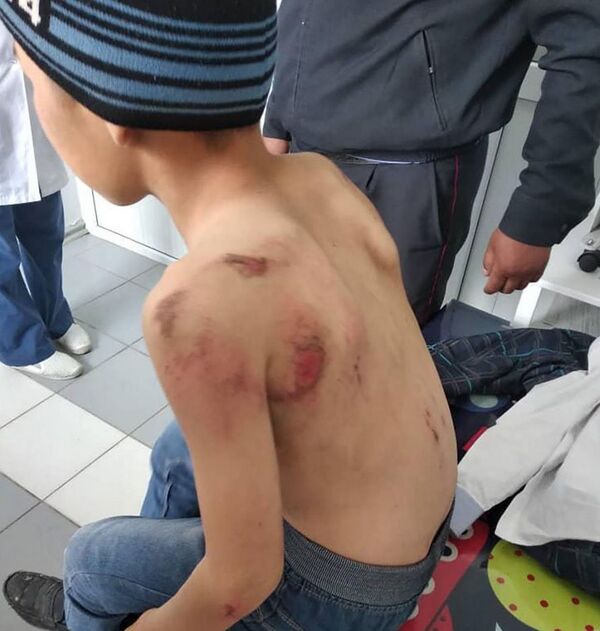 Выяснилось, кто привязал мальчика в Кыргызстане к машине и протащил по земле - Sputnik Узбекистан