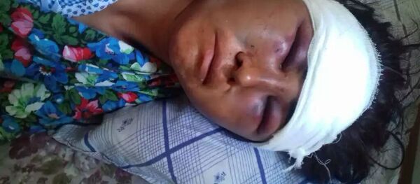 Женщина из Булунгура, пострадавшая от побоев супруга Женщина из Булунгура, пострадавшая от побоев супруга - Sputnik Ўзбекистон