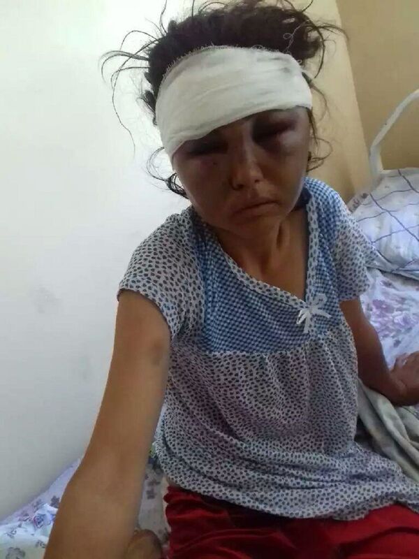 В Узбекистане жених после свадьбы не оставил живого места на лице невесты - Sputnik Узбекистан