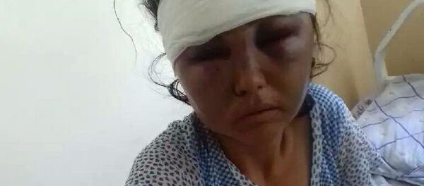 Женщина из Булунгура, пострадавшая от побоев мужа Женщина из Булунгура, пострадавшая от побоев мужа - Sputnik Ўзбекистон