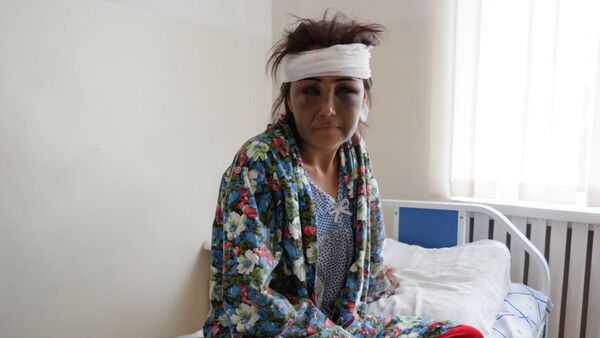 Жестоко избитая супругом жительница Булунгура Зухра Умарова в больничной палате - Sputnik Ўзбекистон