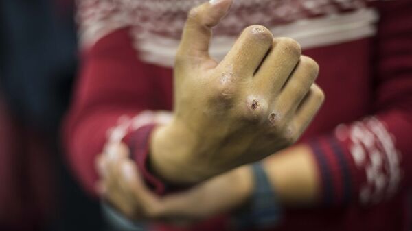 Мужчина показывает разбитый кулак, архивное фото - Sputnik Ўзбекистон