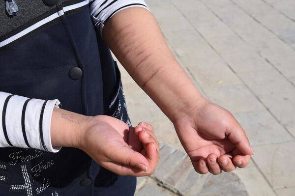 Улицы и шрамы: история узбекской девочки, которую бросил папа - Sputnik Узбекистан