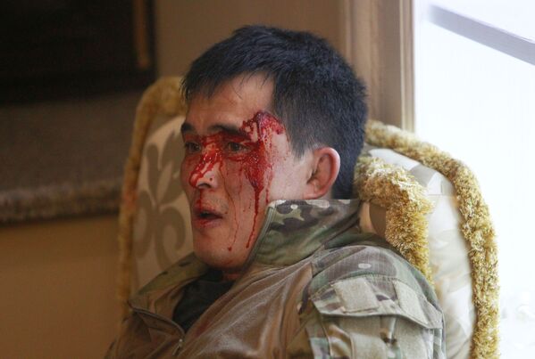 Киргизский полицейский, пострадавший во время спецоперации по задержанию бывшего президента Киргизии Алмазбека Атамбаева - Sputnik Ўзбекистон