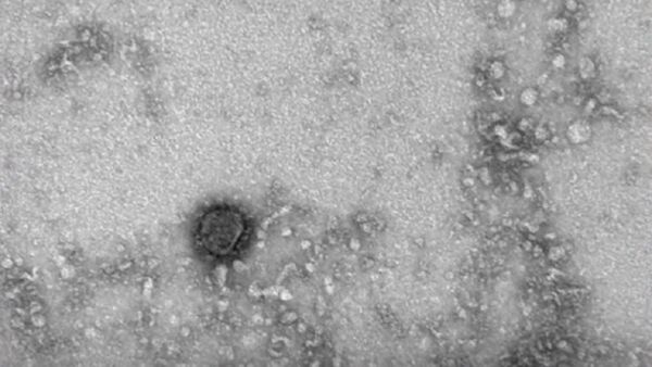 Российские ученые показали, как выглядит коронавирус — видео - Sputnik Узбекистан