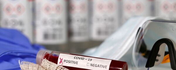 Пробирка с коронавирусом 2019-nCoV Пробирка с коронавирусом 2019-nCoV - Sputnik Ўзбекистон