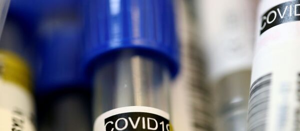 Пробирка с коронавирусом 2019-nCoV Пробирка с коронавирусом 2019-nCoV - Sputnik Ўзбекистон