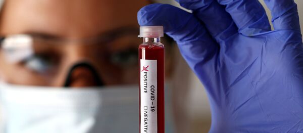 Пробирка с коронавирусом 2019-nCoV Пробирка с коронавирусом 2019-nCoV - Sputnik Ўзбекистон