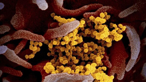 Изображение коронавируса SARS-CoV-2(обозначен желтым цветом), который поражает клетки человека - Sputnik Ўзбекистон
