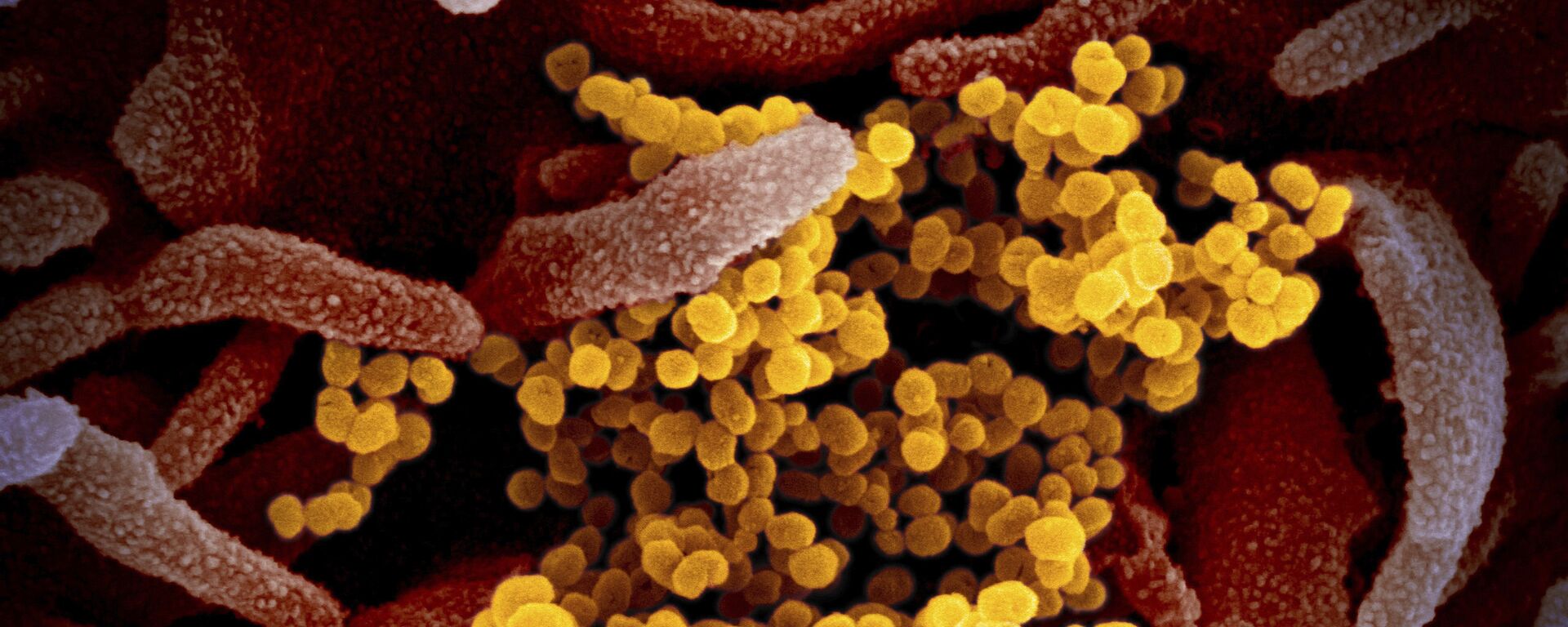 Изображение коронавируса SARS-CoV-2(обозначен желтым цветом), который поражает клетки человека - Sputnik Ўзбекистон, 1920, 19.04.2021