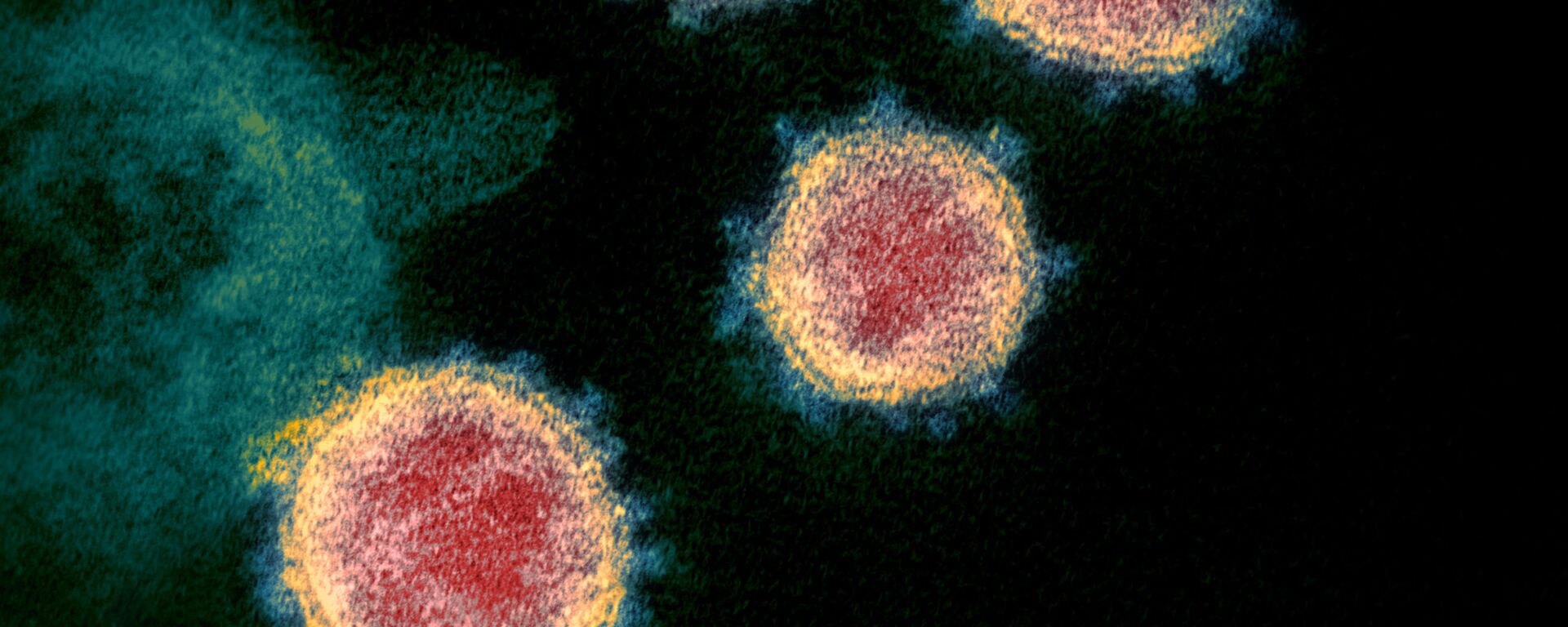 Новый коронавирус атипичной пневмонии SARS-CoV-2. Также известный как 2019-nCoV - Sputnik Ўзбекистон, 1920, 28.08.2020