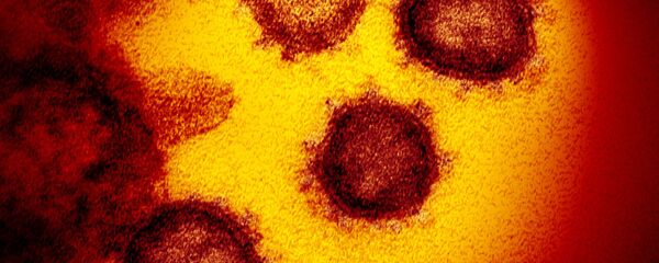 Изображение нового коронавируса атипичной пневмонии SARS-CoV-2. Также известный как 2019-nCoV Изображение нового коронавируса атипичной пневмонии SARS-CoV-2. Также известный как 2019-nCoV - Sputnik Ўзбекистон