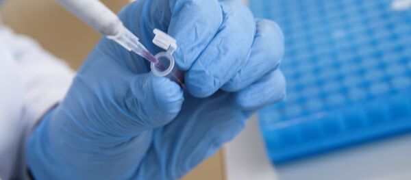 Разработка экспресс-тестов на коронавирус Разработка экспресс-тестов на коронавирус - Sputnik Узбекистан