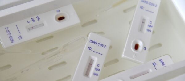 Прохождение экспресс-тестов на выявление коронавируса на Украине - Sputnik Узбекистан