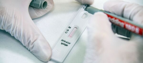 Экспресс-диагностика на антитела к коронавирусу в клинике Hadassah Medical Moscow в Сколково Экспресс-диагностика на антитела к коронавирусу в клинике Hadassah Medical Moscow в Сколково - Sputnik Ўзбекистон