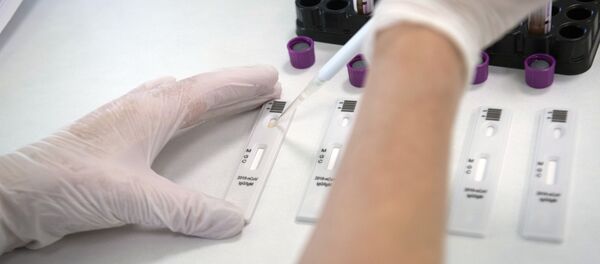 Экспресс-диагностика на антитела к коронавирусу в клинике Hadassah Medical Moscow в Сколково Экспресс-диагностика на антитела к коронавирусу в клинике Hadassah Medical Moscow в Сколково - Sputnik Ўзбекистон