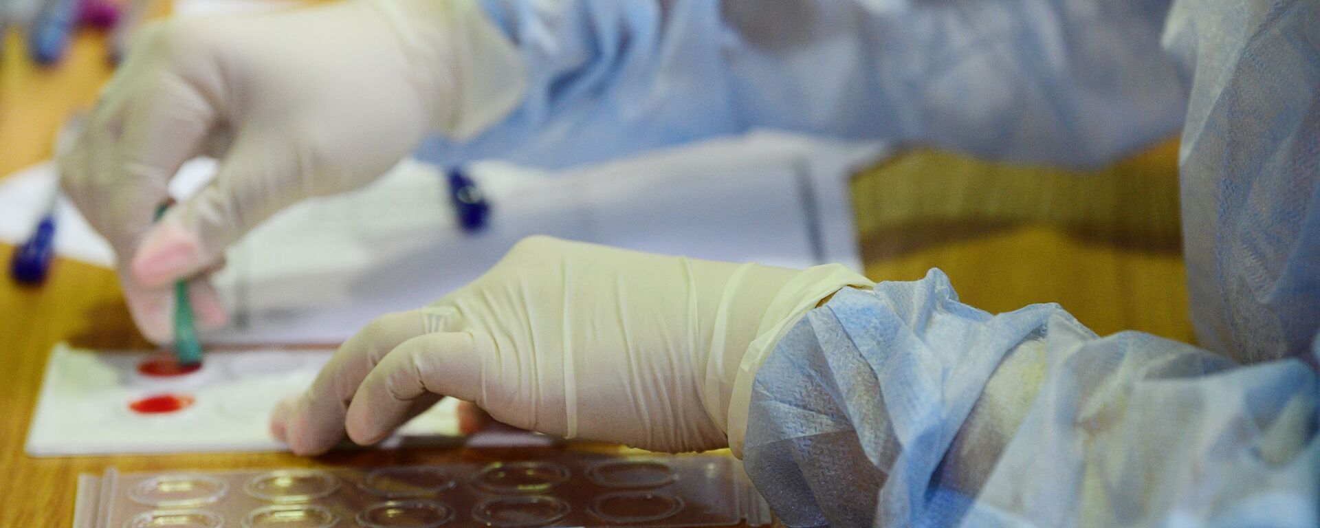 Qon olish, arxiv surat - Sputnik O‘zbekiston, 1920, 23.01.2026