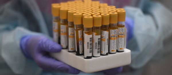 Тестирование россиян на наличие антител к COVID-19 в Москве Тестирование россиян на наличие антител к COVID-19 в Москве - Sputnik Ўзбекистон