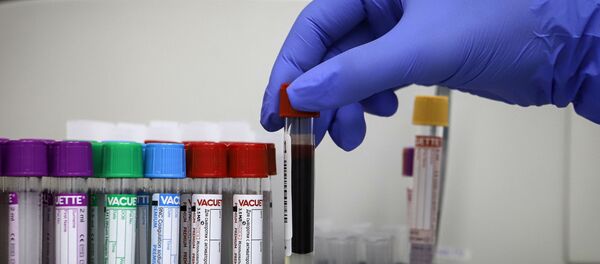 Тестирование на антитела к коронавирусу - Sputnik Узбекистан