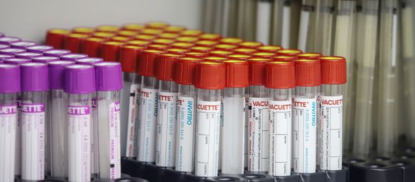 Testirovanie na antitela k koronavirusu - Sputnik O‘zbekiston