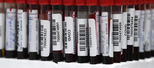 Тестирование на COVID-19 в лаборатории НИИ Склифосовского - Sputnik Ўзбекистон