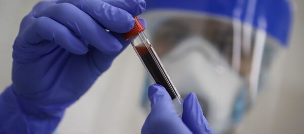 Тестирование на антитела к коронавирусу - Sputnik Ўзбекистон