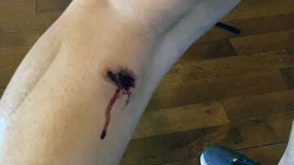 Полиция США выстрелила в продюсера Sputnik резиновыми пулями - фото - Sputnik Узбекистан