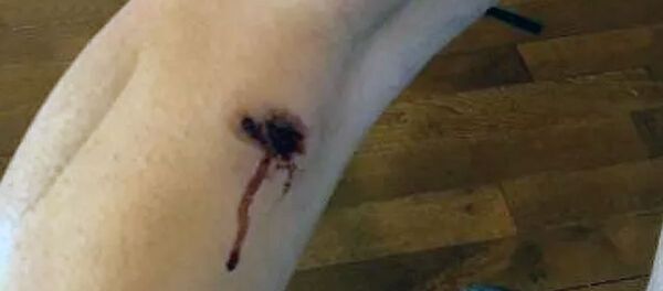 Продюсер Николь Руссел, освещавшая протест у Белого Дома, пострадала от зарядов резиновых пуль и слезоточивого газа Продюсер Николь Руссел, освещавшая протест у Белого Дома, пострадала от зарядов резиновых пуль и слезоточивого газа - Sputnik Ўзбекистон