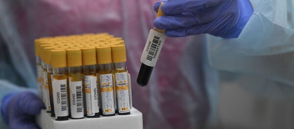 Тестирование россиян на наличие антител к COVID-19 в Москве Тестирование россиян на наличие антител к COVID-19 в Москве - Sputnik Ўзбекистон