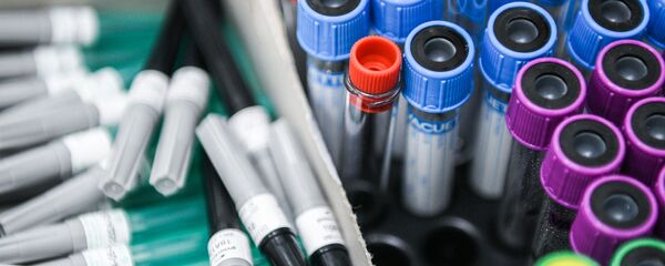 Тестирование россиян на наличие антител к COVID-19 Тестирование россиян на наличие антител к COVID-19 - Sputnik Узбекистан