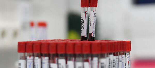 Тестирование на COVID-19 в лаборатории НИИ Склифосовского Тестирование на COVID-19 в лаборатории НИИ Склифосовского - Sputnik Ўзбекистон