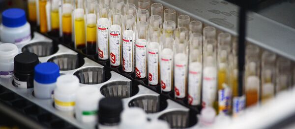 Исследование крови на инфекции - Sputnik Узбекистан