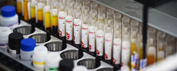 Лаборатория иммуноферментных исследований - Sputnik Ўзбекистон